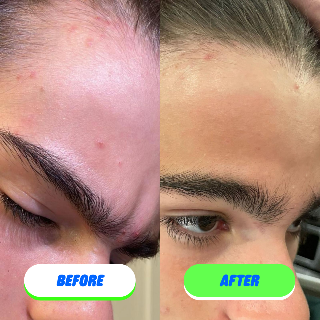 Pipa Skin Care - Pipa Skin Saver Hypochlorous Acid Face and Body Spray